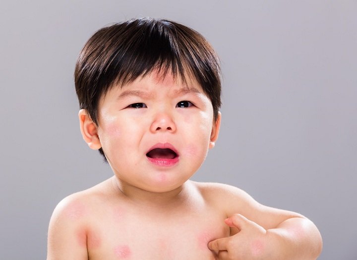 Bé ăn cháo thịt bò bị dị ứng có sao không và cách xử lý